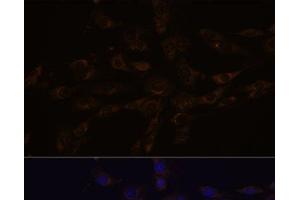 Immunofluorescence analysis of C6 cells using RGS4 Polyclonal Antibody at dilution of 1:100. (RGS4 Antikörper)