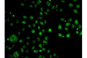 Immunofluorescence analysis of A-549 cells using LDLR antibody (ABIN6127366, ABIN6143131, ABIN6143132 and ABIN6222897). (LDLRAP1 Antikörper  (AA 59-308))
