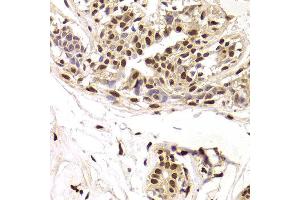 Immunohistochemistry of paraffin-embedded Human mammary gland using SNRPA antibody at dilution of 1:100 (x400 lens). (SNRPA1 Antikörper)