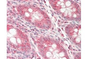 Immunohistochemistry (Paraffin-embedded Sections) (IHC (p)) image for anti-UDP-Gal:betaGlcNAc beta 1,4- Galactosyltransferase, Polypeptide 3 (B4GALT3) antibody (HRP) (ABIN1958022)