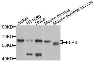 Western blot analysis of extracts of various cells, using ELP3 antibody. (ELP3/KAT9 Antikörper)