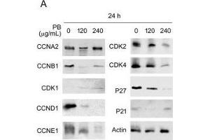 PB downregulates several proteins related to cell cycle progression, morphology, cell-cell adhesion and cell migration. (CDK2 Antikörper)