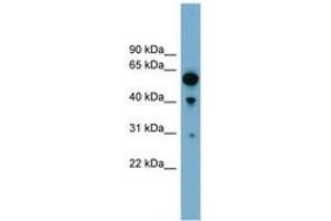 Image no. 1 for anti-rho GTPase Activating Protein 15 (ARHGAP15) (AA 251-300) antibody (ABIN6744151) (ARHGAP15 Antikörper  (AA 251-300))