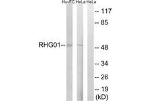 Western blot analysis of extracts from HeLa/HuvEc cells, using RHG1 Antibody. (RHG1 (AA 189-238) Antikörper)