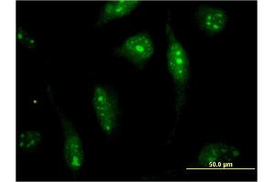Immunofluorescence of monoclonal antibody to SOLH on HeLa cell. (Calpain 15/SOLH Antikörper  (AA 993-1086))