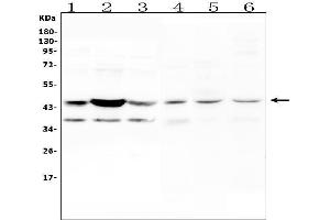 Western blot analysis of CCR2 using anti-CCR2 antibody (ABIN6719404).