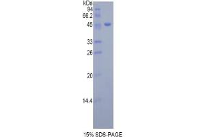 SDS-PAGE analysis of Mouse Dermatopontin Protein. (Dermatopontin Protein (DPT))