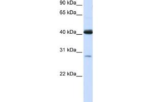WB Suggested Anti-GCDH Antibody Titration:  0. (GCDH Antikörper  (N-Term))
