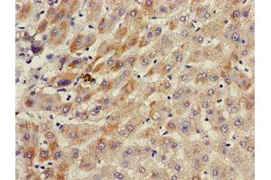 Immunohistochemistry of paraffin-embedded human liver tissue using ABIN7143187 at dilution of 1:100 (ACAD11 Antikörper  (AA 225-388))