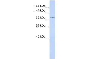 WB Suggested Anti-TRPC6 Antibody Titration:  0. (TRPC6 Antikörper  (Middle Region))