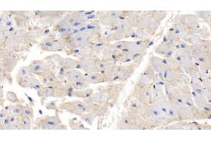 Immunohistochemistry (IHC) image for anti-Lectin, Galactoside-Binding, Soluble, 1 (LGALS1) (AA 1-135) antibody (ABIN7431626)