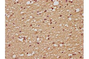 IHC image of ABIN7175125 diluted at 1:200 and staining in paraffin-embedded human brain tissue performed on a Leica BondTM system. (PLAUR Antikörper  (AA 23-305))