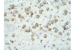 Rabbit Anti-MED17 Antibody       Paraffin Embedded Tissue:  Human neural cell   Cellular Data:  Epithelial cells of renal tubule  Antibody Concentration:   4.