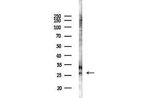 anti-Insulin-Like Growth Factor Binding Protein 1 (IGFBPI) (C-Term) antibody