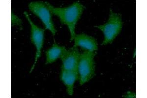 ICC/IF analysis of DYNLL in A549 cells line, stained with DAPI (Blue) for nucleus staining and monoclonal anti-human DYNLL antibody (1:100) with goat anti-mouse IgG-Alexa fluor 488 conjugate (Green).