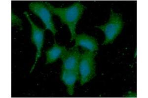 ICC/IF analysis of DYNLL in A549 cells line, stained with DAPI (Blue) for nucleus staining and monoclonal anti-human DYNLL antibody (1:100) with goat anti-mouse IgG-Alexa fluor 488 conjugate (Green). (DYNLL1 Antikörper)