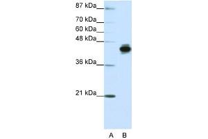 WB Suggested Anti-KRT18 Antibody Titration:  1. (Cytokeratin 18 Antikörper  (N-Term))