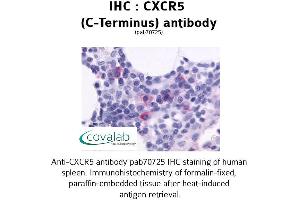 Image no. 1 for anti-Chemokine (C-X-C Motif) Receptor 5 (CXCR5) (C-Term) antibody (ABIN1733411) (CXCR5 Antikörper  (C-Term))