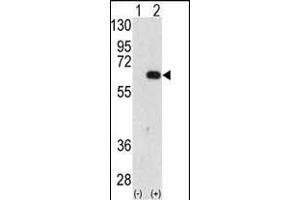 Western blot analysis of FR (arrow) using FR Antibody (C-term) (ABIN388938 and ABIN2850529). (AMFR Antikörper  (AA 571-601))