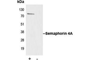 Immunoprecipitation of Semaphorin 4A from 0.