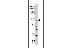 Western blot analysis of CPT1A polyclonal antibody  in Y-79 cell line lysate (35 ug/lane). (CPT1A Antikörper  (C-Term))