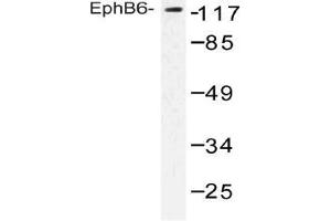 Western blot (WB) analysis of EphB6 antibody in extracts from COLO cells.