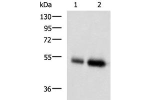 Western blot analysis of Human placenta tissue and Human right lower lung tissue lysates using BMP5 Polyclonal Antibody at dilution of 1:450 (BMP5 Antikörper)