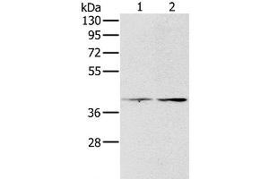 Western Blot analysis of Hela and lovo cell using PDGFRL Polyclonal Antibody at dilution of 1:400 (PDGFRL Antikörper)