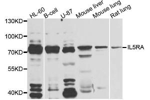 Western blot analysis of extracts of various cell lines, using IL5RA antibody. (IL5RA Antikörper)