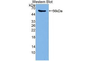 Western blot analysis of the recombinant protein. (PDE4D Antikörper  (AA 581-809))