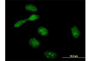 Immunofluorescence (IF) image for anti-Crossover junction endonuclease EME1 (EME1) (AA 1-583) antibody (ABIN530922)