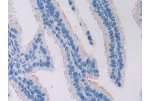 Detection of ADCY6 in Mouse Oviduct Tissue using Polyclonal Antibody to Adenylate Cyclase 6 (ADCY6)