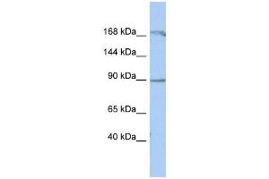 NARG1 antibody used at 1 ug/ml to detect target protein. (NAA15 Antikörper  (Middle Region))