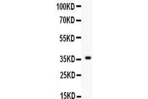 Western Blotting (WB) image for anti-Fibroblast Growth Factor 1 (Acidic) (FGF1) (AA 22-146) antibody (ABIN3042389) (FGF1 Antikörper  (AA 22-146))