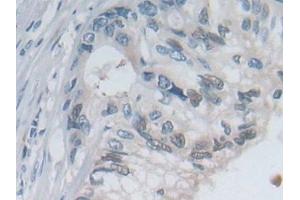 Immunohistochemistry (IHC) image for anti-Selectin P (Granule Membrane Protein 140kDa, Antigen CD62) (SELP) (AA 198-432) antibody (ABIN7441859)