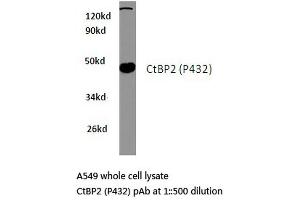 Western blot (WB) analysis of CtBP2 antibody in extracts from A549 cells. (CTBP2 Antikörper)