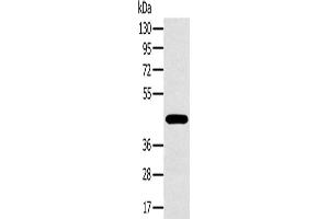 Western Blotting (WB) image for anti-Melanoma Antigen Family A, 10 (MAGEA10) antibody (ABIN2423753)