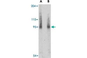 Western blot analysis of BICD2 in A-549 cell lysate with BICD2 polyclonal antibody  at (A) 1 and (B) 2 ug/mL . (BICD2 Antikörper  (Internal Region))