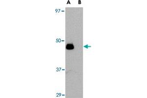 Western blot analysis of IL34 in human brain tissue lysate with IL34 polyclonal antibody  at 0. (IL-34 Antikörper  (N-Term))