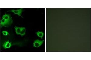 Immunofluorescence analysis of COS7 cells, using CYSLTR1 Antibody. (CysLTR1 Antikörper  (AA 131-180))