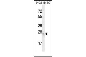 Western blot analysis of C16orf45 Antibody (Center) in NCI-H460 cell line lysates (35ug/lane).