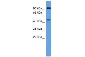 Western Blot showing Ece2 antibody used at a concentration of 1-2 ug/ml to detect its target protein. (ECE2 Antikörper  (Middle Region))