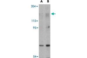 Western blot analysis of RPTOR in L1210 cell lysate with RPTOR polyclonal antibody  at (A) 2 and (B) 4 ug/mL . (Raptor Antikörper  (N-Term))