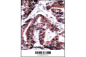 Immunohistochemistry (IHC) image for anti-Transcription Elongation Factor B (SIII), Polypeptide 1 (15kDa, Elongin C) (TCEB1) (AA 69-98), (C-Term) antibody (ABIN5536079)
