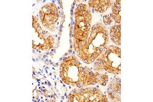 Iunohistochemical analysis of paraffin-embedded H.
