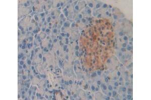 Used in DAB staining on fromalin fixed paraffin- embedded Kidney tissue (CXCL5 Antikörper  (AA 41-132))