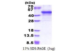 MMP3 Protein (AA 100-477) (His tag)