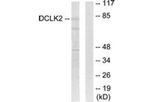 Western Blotting (WB) image for anti-Doublecortin-Like Kinase 2 (DCLK2) (AA 1-50) antibody (ABIN2889673) (DCLK2 Antikörper  (AA 1-50))