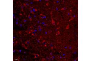 Immunofluorescence of paraffin embedded rat substantia nigra using VIRL2 (ABIN7076206) at dilution of 1: 700 (400x lens) (VN1R2 Antikörper)