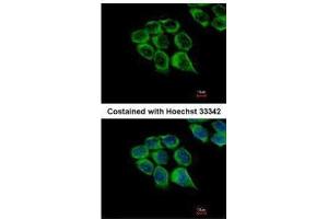 ICC/IF Image Immunofluorescence analysis of methanol-fixed HCT116, using C1r, antibody at 1:500 dilution. (C1R Antikörper)
